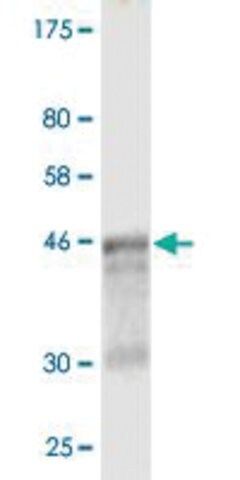 Monoclonal Anti-WISP2 antibody produced in mouse