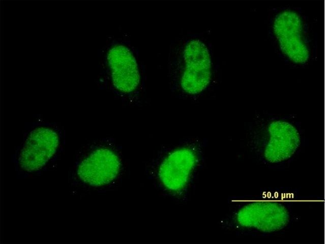 Monoclonal Anti-SMARCD2 antibody produced in mouse