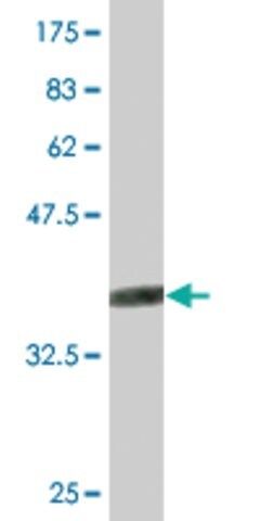 Monoclonal Anti-SMCP antibody produced in mouse