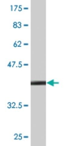 Monoclonal Anti-TFF2 antibody produced in mouse