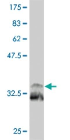 Monoclonal Anti-TITF1 antibody produced in mouse