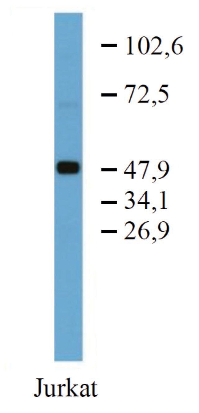 Monoclonal Anti-TFG antibody produced in mouse