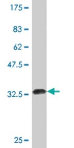 Monoclonal Anti-TFF3, (C-terminal) antibody produced in mouse