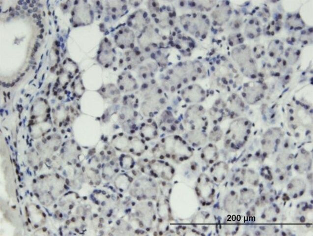 Monoclonal Anti-THRSP, (N-terminal) antibody produced in mouse