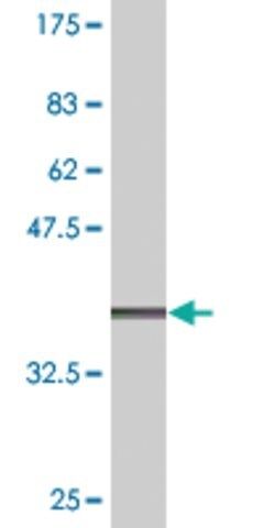 Monoclonal Anti-TMPRSS2, (C-terminal) antibody produced in mouse