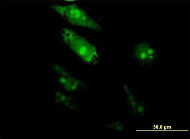 Monoclonal Anti-TGIF2, (C-terminal) antibody produced in mouse