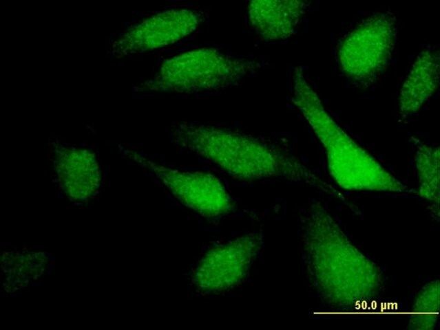 Monoclonal Anti-TNRC6C antibody produced in mouse