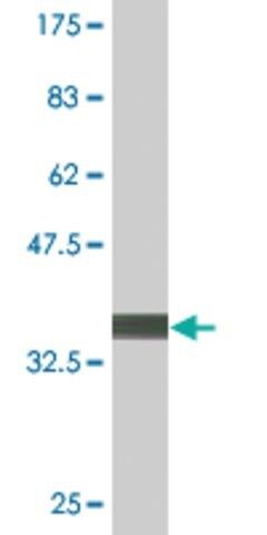 Monoclonal Anti-TOPORS antibody produced in mouse