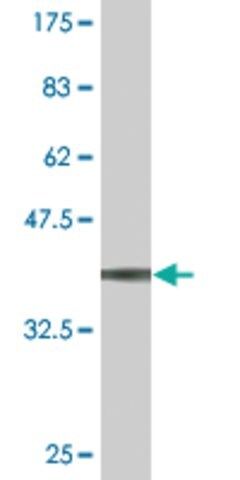 Monoclonal Anti-TOPORS antibody produced in mouse