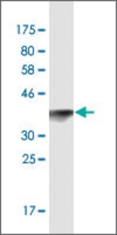 Monoclonal Anti-TOPORS antibody produced in mouse