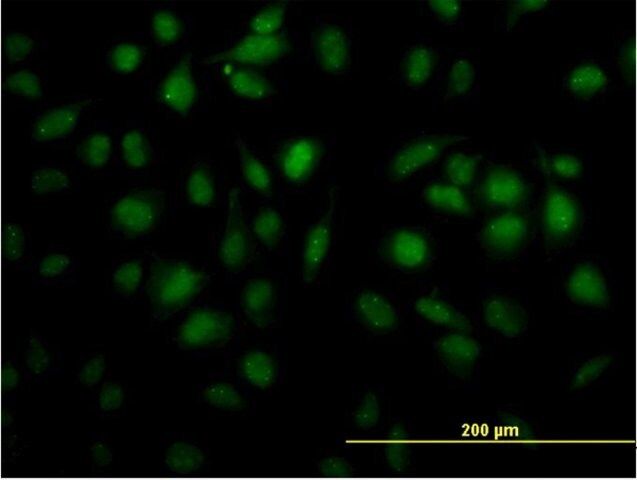 Monoclonal Anti-TOE1 antibody produced in mouse