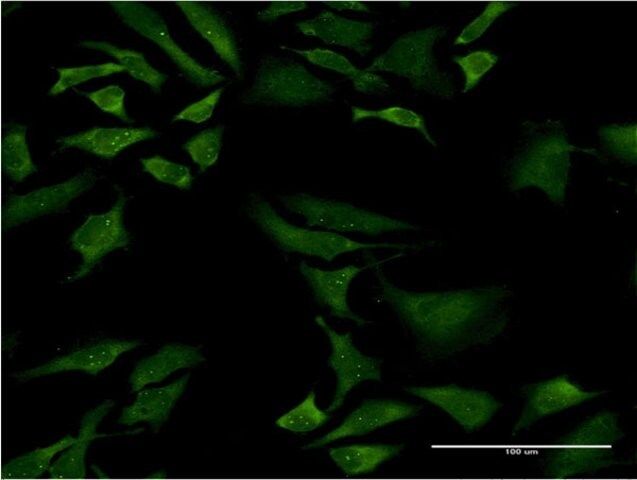 Monoclonal Anti-SMN2 antibody produced in mouse