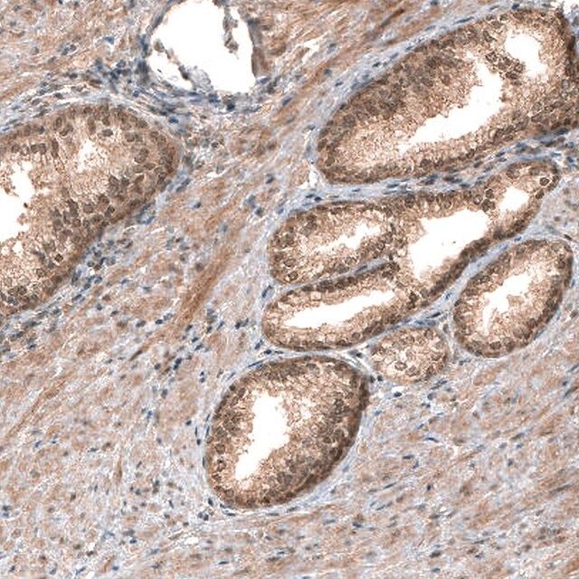 Monoclonal Anti-SMAD4 antibody produced in mouse