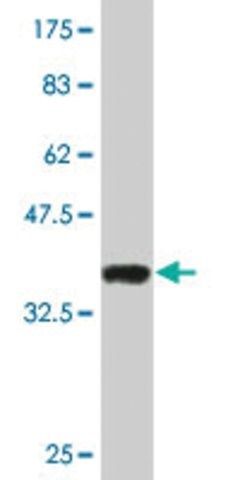 Monoclonal Anti-SMARCD3, (C-terminal) antibody produced in mouse