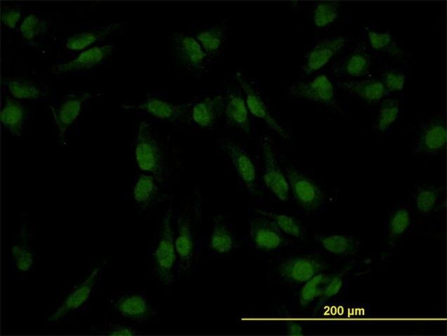 Monoclonal Anti-SMAD4 antibody produced in mouse