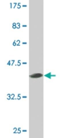 Monoclonal Anti-SMO, (C-terminal) antibody produced in mouse