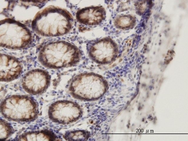 Monoclonal Anti-SMAD1 antibody produced in mouse