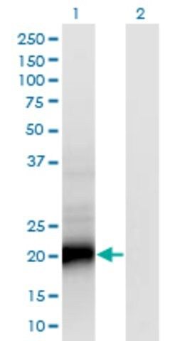 Monoclonal Anti-SMUG1 antibody produced in mouse