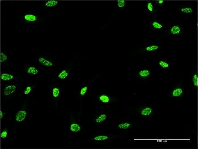 Monoclonal Anti-PTPN22 antibody produced in mouse