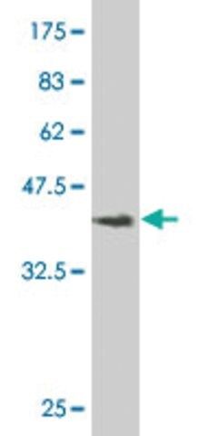 Monoclonal Anti-PTX3, (C-terminal) antibody produced in mouse