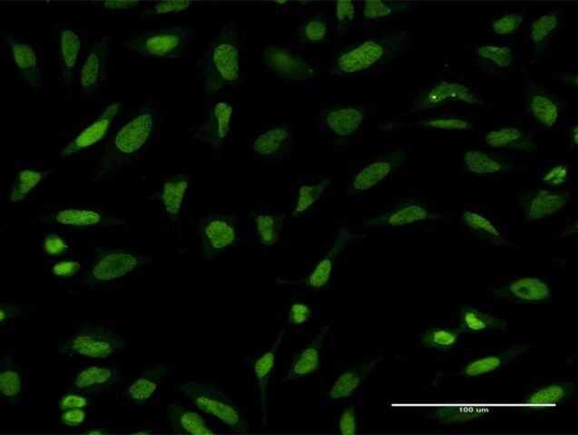 Monoclonal Anti-PTTG1 antibody produced in mouse