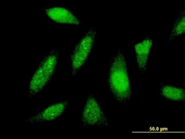 Monoclonal Anti-PTTG1IP antibody produced in mouse