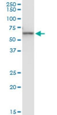 Monoclonal Anti-KRT6B antibody produced in mouse