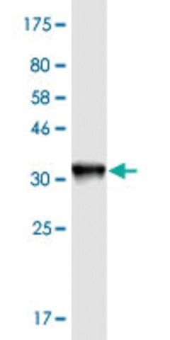 Monoclonal Anti-KNTC1, (C-terminal) antibody produced in mouse