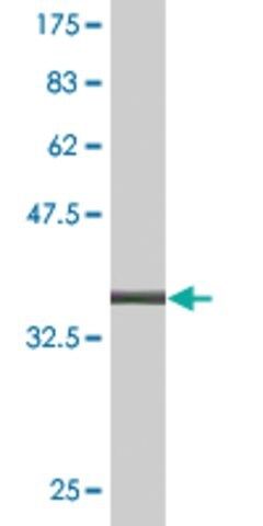 Monoclonal Anti-LCN1 antibody produced in mouse