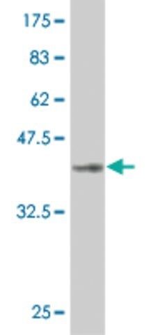 Monoclonal Anti-LHX1, (N-terminal) antibody produced in mouse