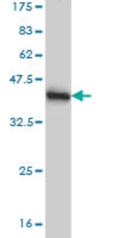 Monoclonal Anti-LDB1, (N-terminal) antibody produced in mouse