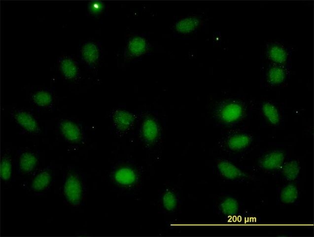 Monoclonal Anti-LASS4 antibody produced in mouse