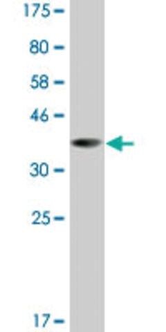 Monoclonal Anti-LHX5 antibody produced in mouse