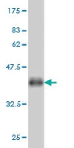 Monoclonal Anti-LMTK3 antibody produced in mouse