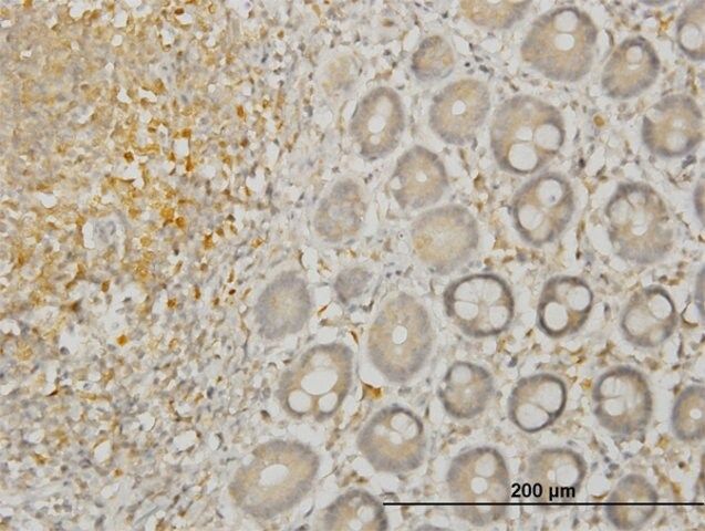 Monoclonal Anti-LIMK1, (C-terminal) antibody produced in mouse