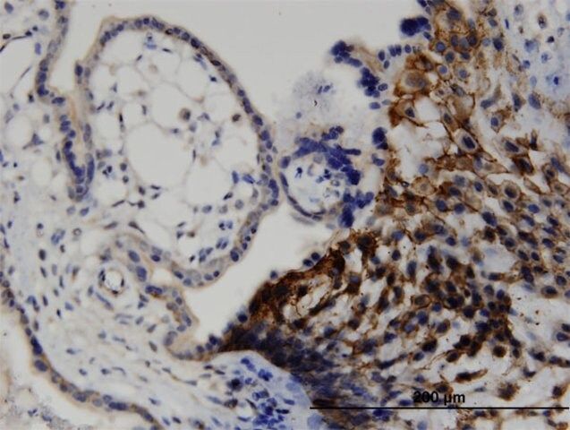 Monoclonal Anti-LIMA1, (N-terminal) antibody produced in mouse