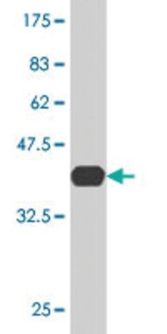 Monoclonal Anti-LIG4, (C-terminal) antibody produced in mouse