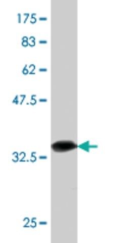 Monoclonal Anti-LIPF, (C-terminal) antibody produced in mouse