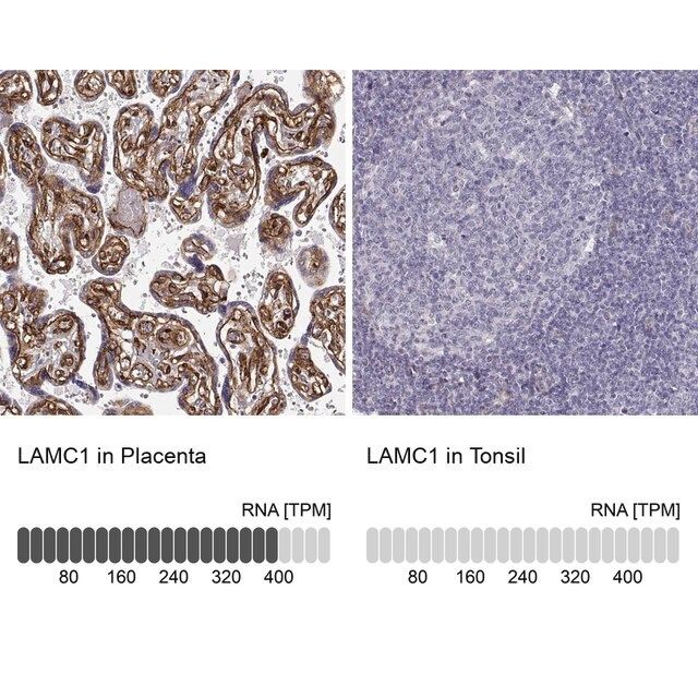 Monoclonal Anti-LAMC1 antibody produced in mouse