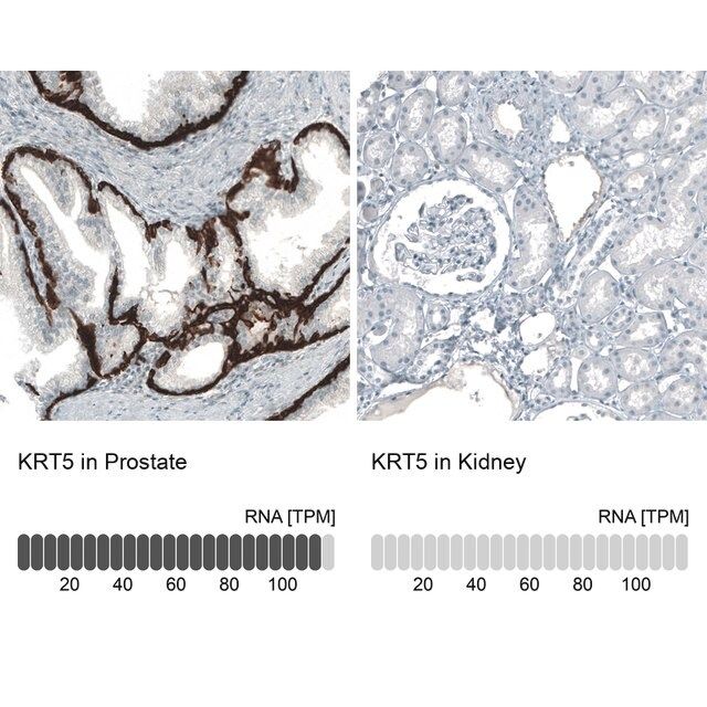 Monoclonal Anti-KRT5 antibody produced in mouse