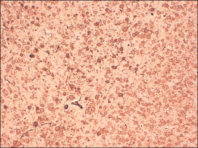 Monoclonal Anti-KCNB1 antibody produced in mouse