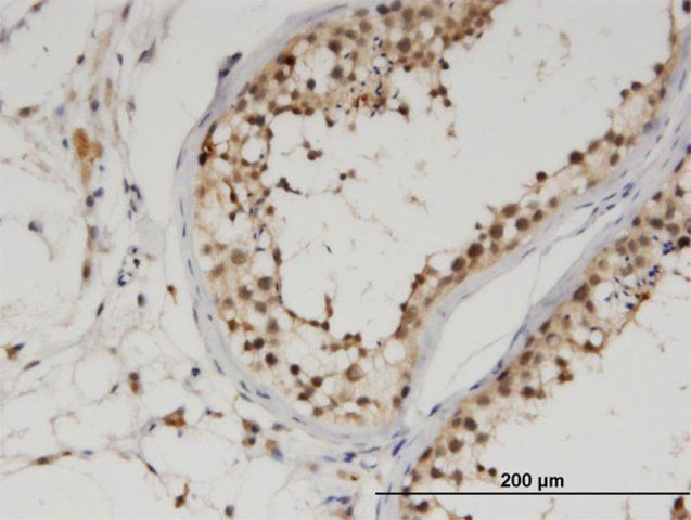 Monoclonal Anti-FLJ10808, (C-terminal) antibody produced in mouse