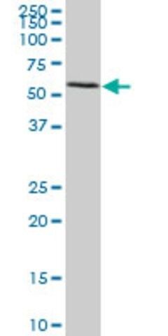 Monoclonal Anti-FGL2 antibody produced in mouse