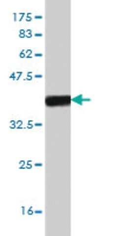 Monoclonal Anti-FOXF2 antibody produced in mouse