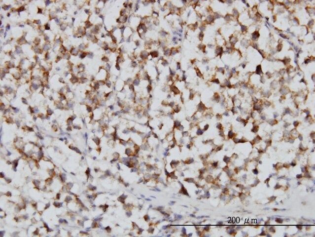 Monoclonal Anti-FH, (C-terminal) antibody produced in mouse