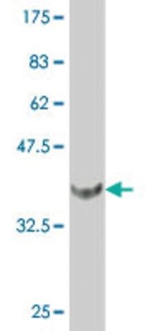 Monoclonal Anti-FOXF2 antibody produced in mouse