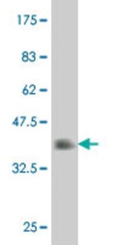 Monoclonal Anti-FOXF2 antibody produced in mouse