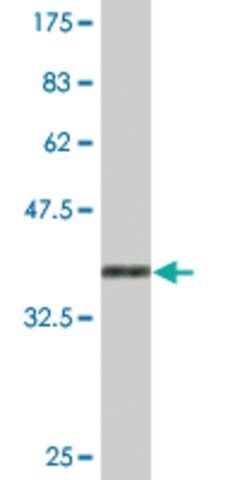 Monoclonal Anti-FOXP4, (C-terminal) antibody produced in mouse