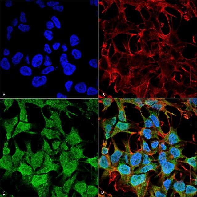 Monoclonal Anti-GABA A Receptor antibody produced in mouse