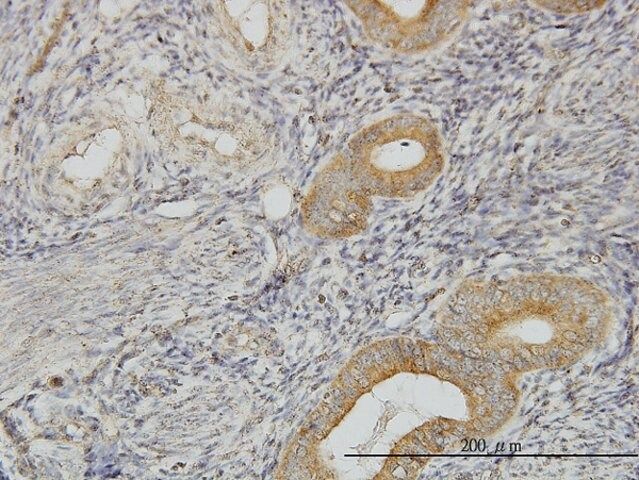 Monoclonal Anti-FLJ20643 antibody produced in mouse